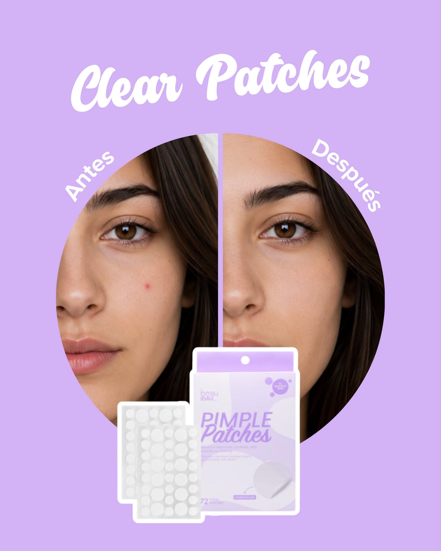 PARCHES TRANSPARENTES PIMPLE PATCHES BEAUVISAGE